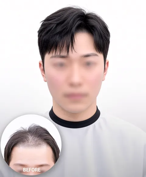 남성 자연스러운 가르마 스타일과 왼쪽 아래 이전 이미지